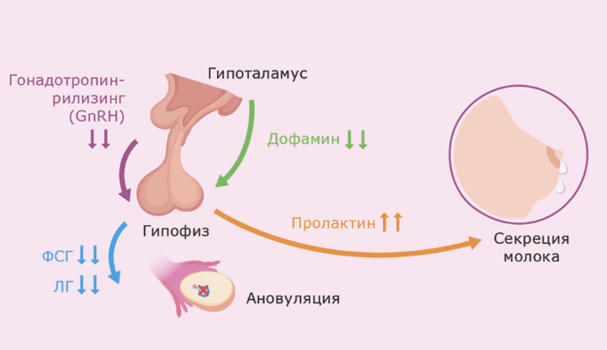 Гиперпролактинемия